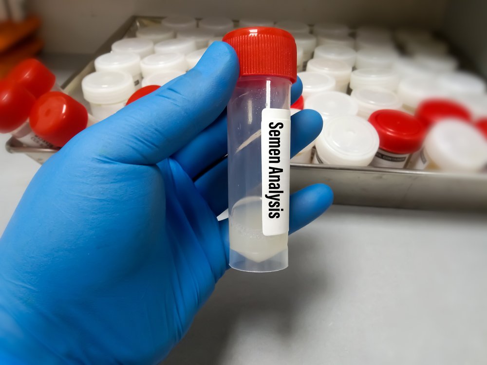 SEMEN ANALYSIS